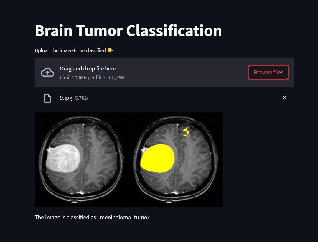 Brain Tumor Classification ? MRI deep learning project preview